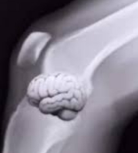 Knee Brain